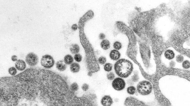 Νιγηρία: Περισσότεροι από 100 νεκροί από πυρετό Λάσα, πρώτο κρούσμα στο Λάγος