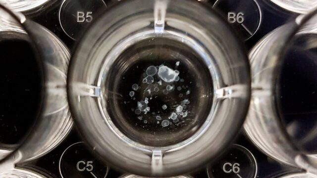 Καταπληκτική ανακάλυψη με επικεφαλής Έλληνα! Θαυματουργή θεραπεία (vid.)