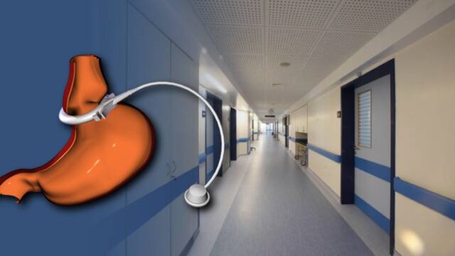 Από τι πέθανε 14χρονη που έβαλε γαστρικό δακτύλιο