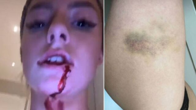 Σύντροφος ποδοσφαιριστή τον καταγγέλλει για ξυλοδαρμό! (video)