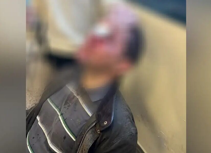 Αποτροπιασμός από την τραμπούκικη επίθεση στη Νομική
