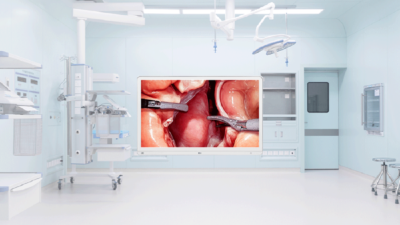 Η LG παρουσιάζει χειρουργική οθόνη 4K με έξυπνες λειτουργίες