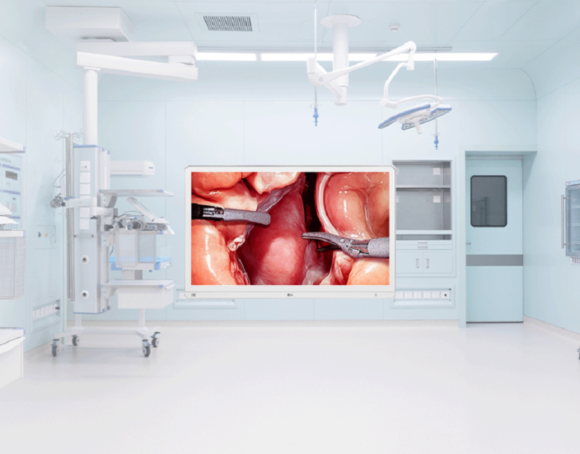 Η LG παρουσιάζει χειρουργική οθόνη 4K με έξυπνες λειτουργίες