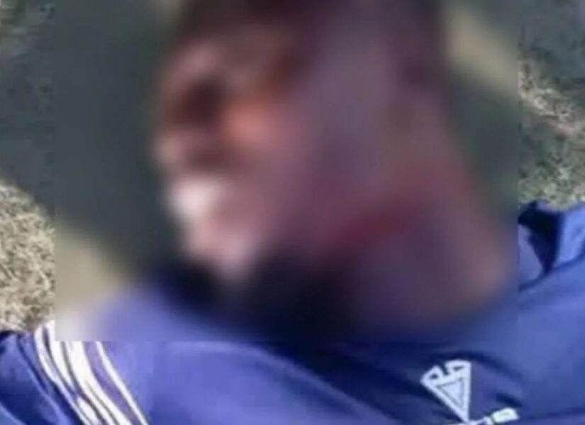 Σοκαριστική επίθεση με μαχαίρι σε ποδοσφαιριστή στη Νιγηρία