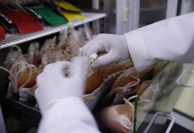 Τι πρέπει να τρώει όποιος κάνει αιμοκάθαρση