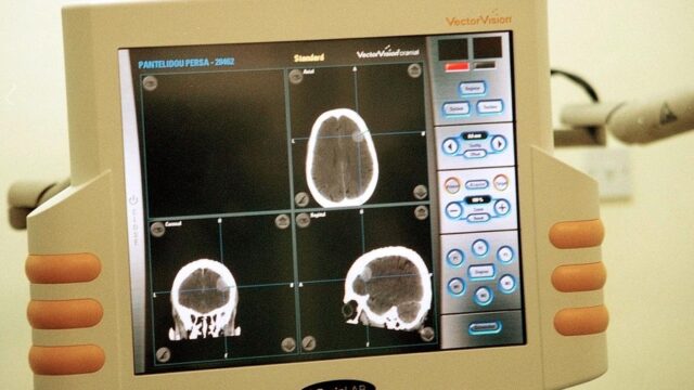 Ποια διατροφή είναι κατάλληλη για την ινομυαλγία