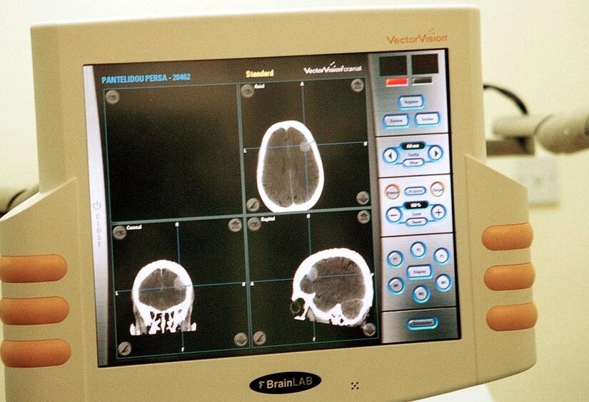 Ποια διατροφή είναι κατάλληλη για την ινομυαλγία